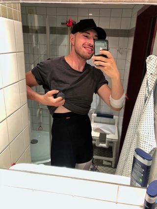 Bauchdeckenstraffung beim Mann mit Kompressionsgurt KPlus von LIPOELASTIC.